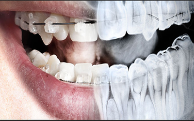 oral-medicine-and-radiology